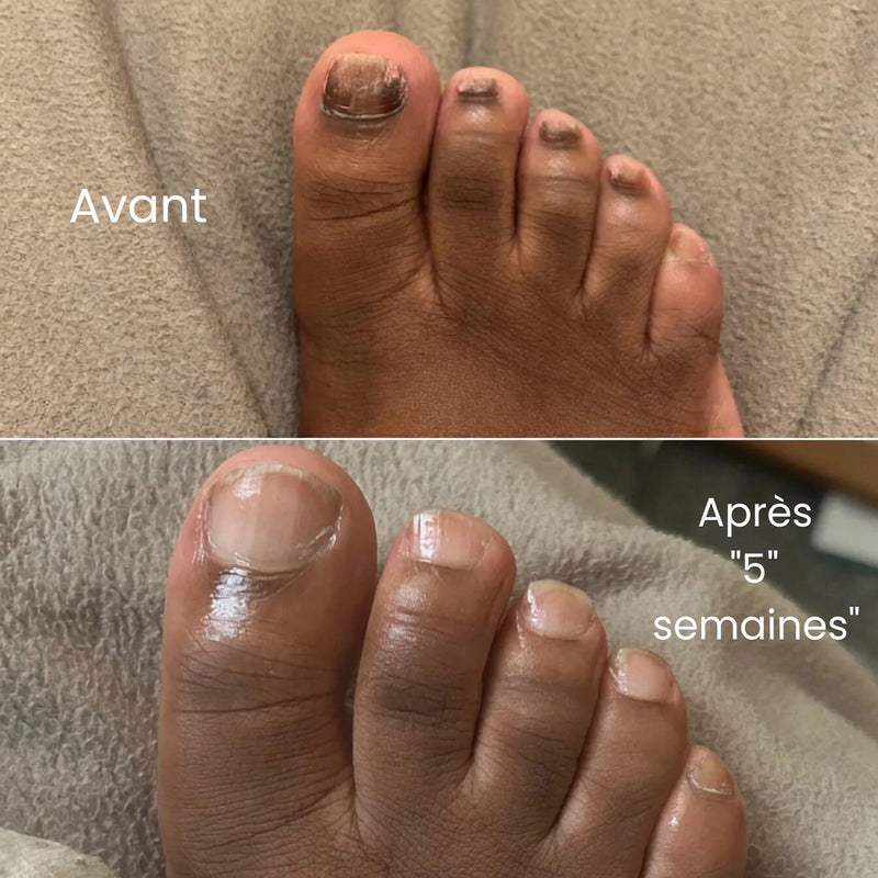 Transformation rapide