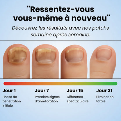 Orvenia - Fungal Nail Patches